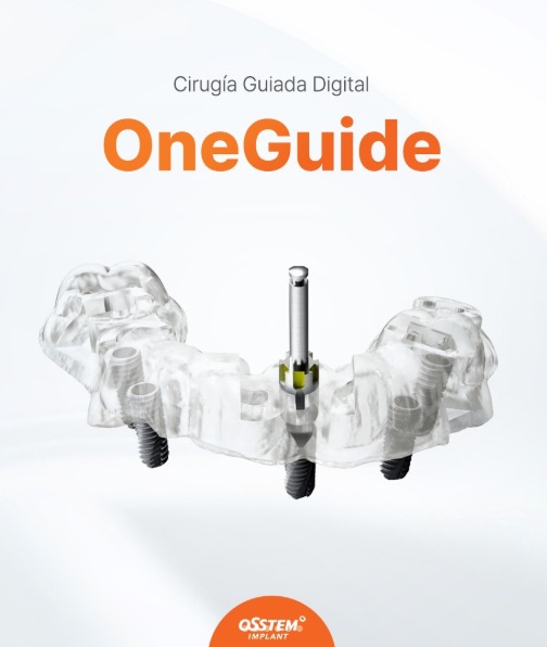 Parámetros para diseño de guía quirúrgica Osstem